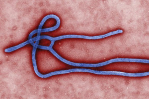 #28 L’Ebola Virus ed i Virus Emergenti Parte Seconda